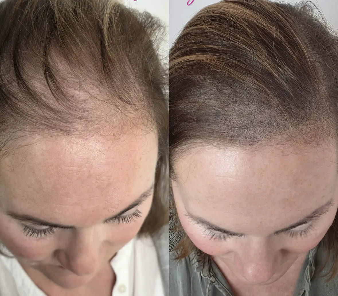 Sabrina Poser Friseur La Biosthétique Herford Microhaarpigmentierung 01