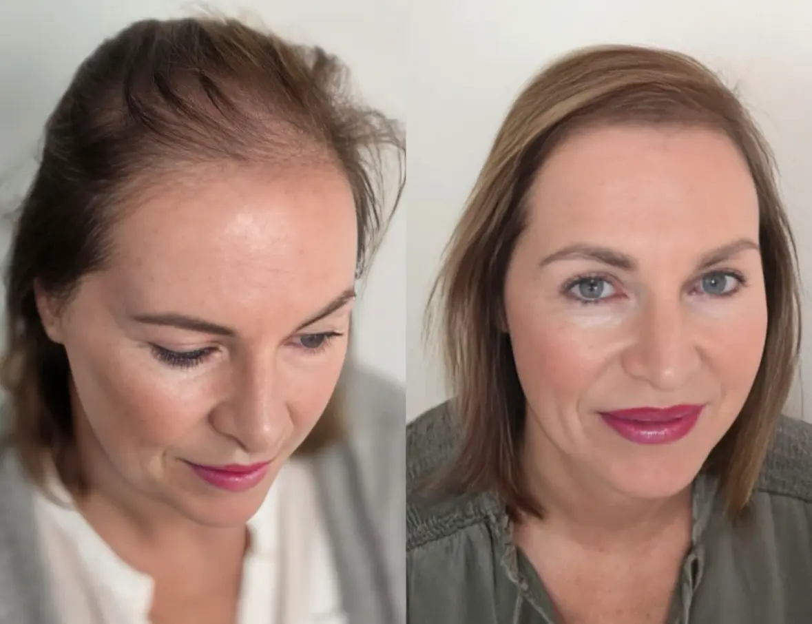 Sabrina Poser Friseur La Biosthétique Herford Microhaarpigmentierung 02