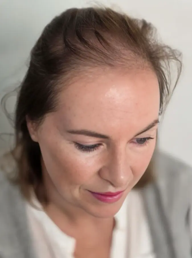 Sabrina Poser Friseur La Biosthétique Herford Microhaarpigmentierung 03